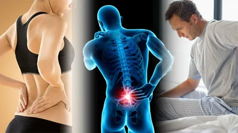 backrelief